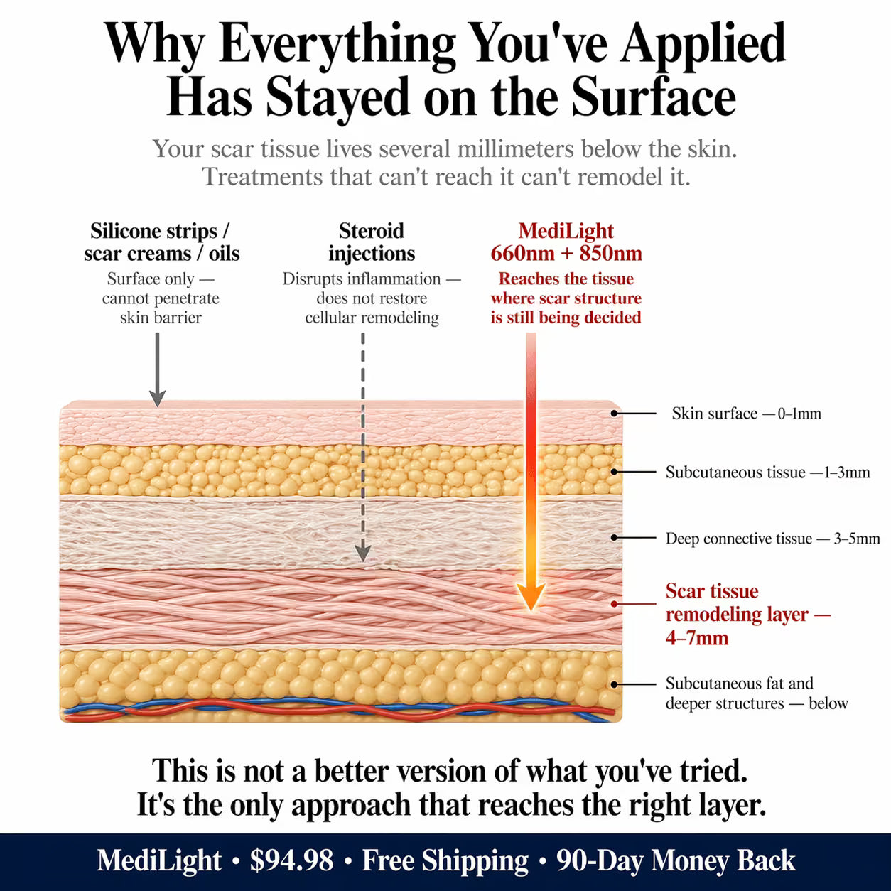 MediLight Deep Impulse — Post-Surgical Scar Recovery