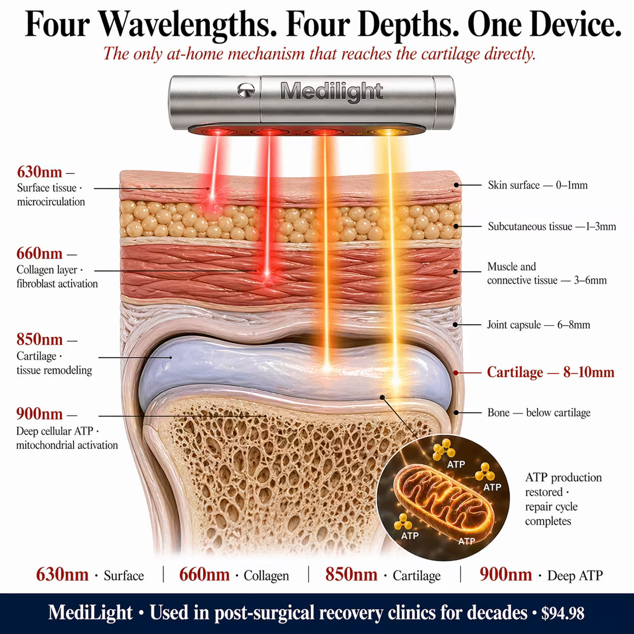 MediLight Deep Impulse — Anti Knee Pain
