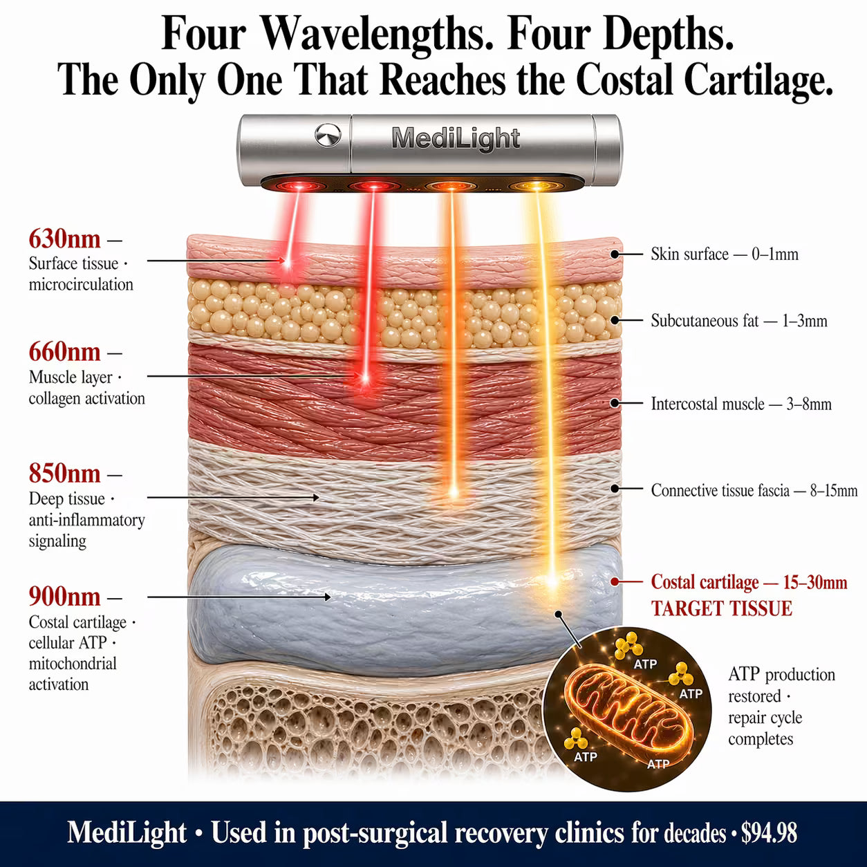 MediLight Deep Impulse — Anti Costochondritis