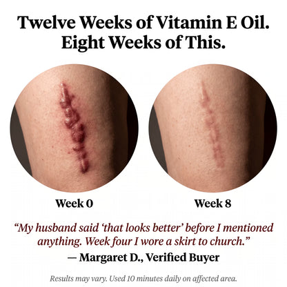 MediLight Deep Impulse — Post-Surgical Scar Recovery