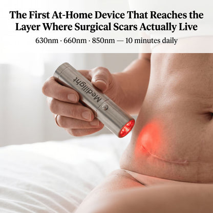 MediLight Deep Impulse — Post-Surgical Scar Recovery