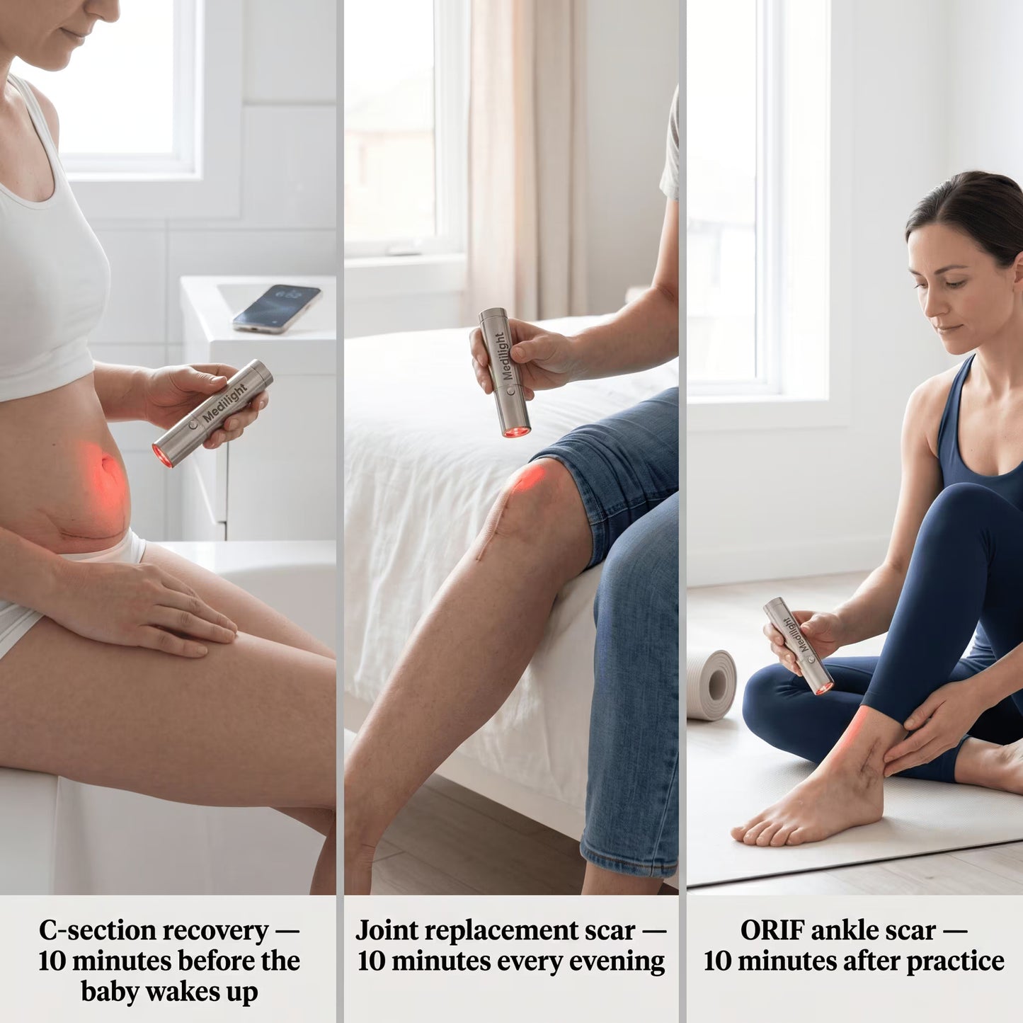 MediLight Deep Impulse — Post-Surgical Scar Recovery