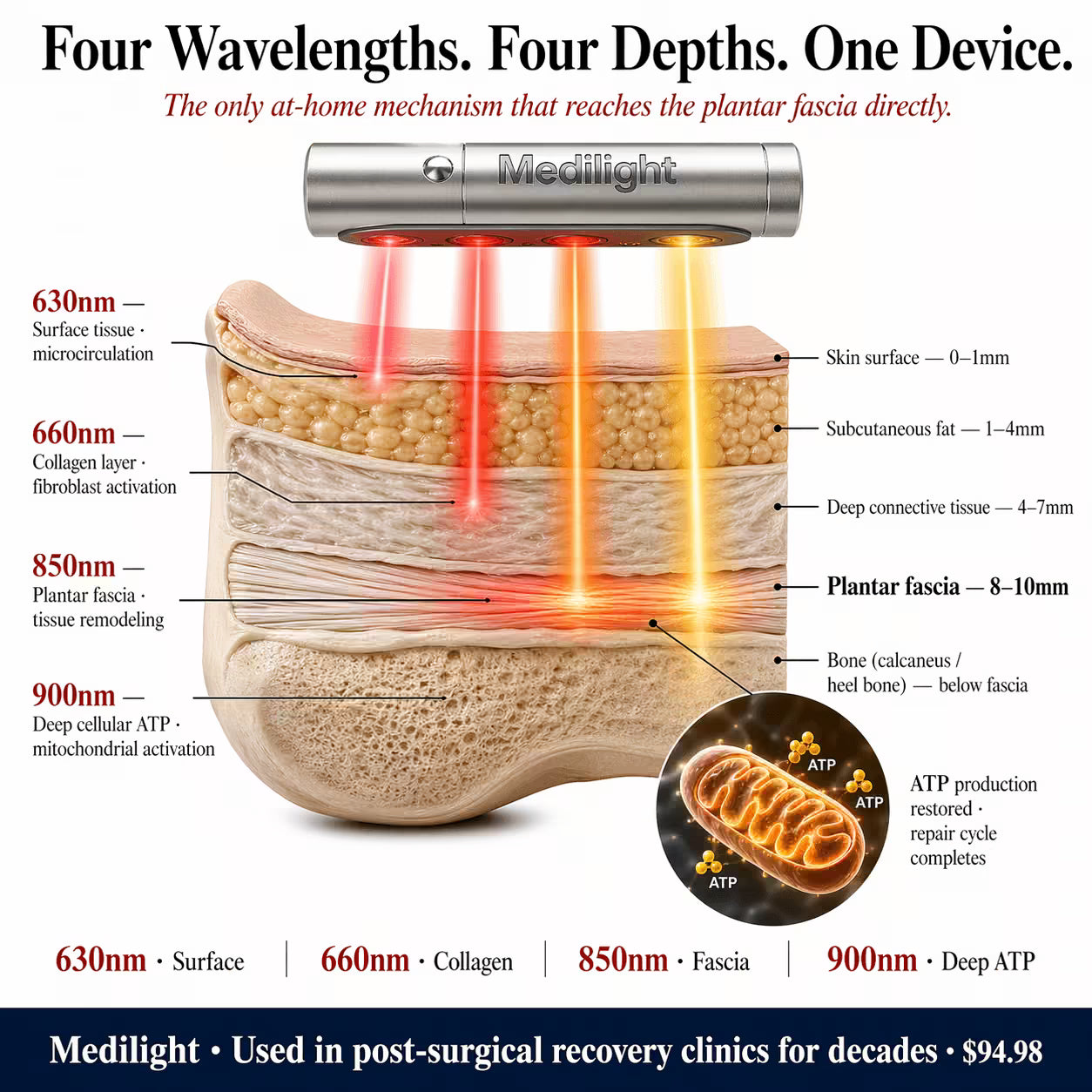 MediLight Deep Impulse - Anti Plantar Fasciitis